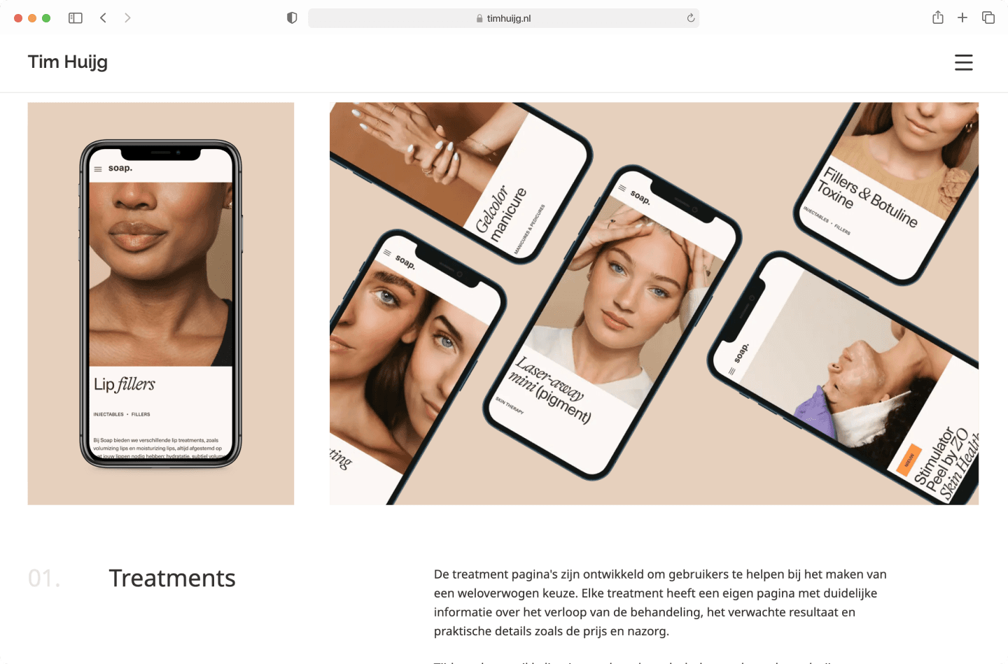 Smartphones display beauty treatment options like lip fillers and manicures, with descriptive text in Dutch.
